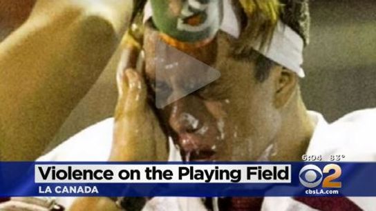 A HS player in California is accused of rubbing Icy Hot on a player's face during a game (Featured)