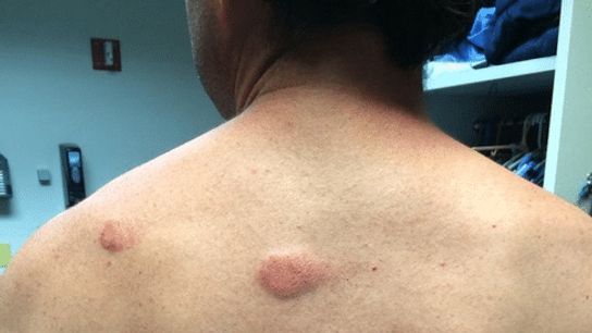 And the winner in paintball today was...